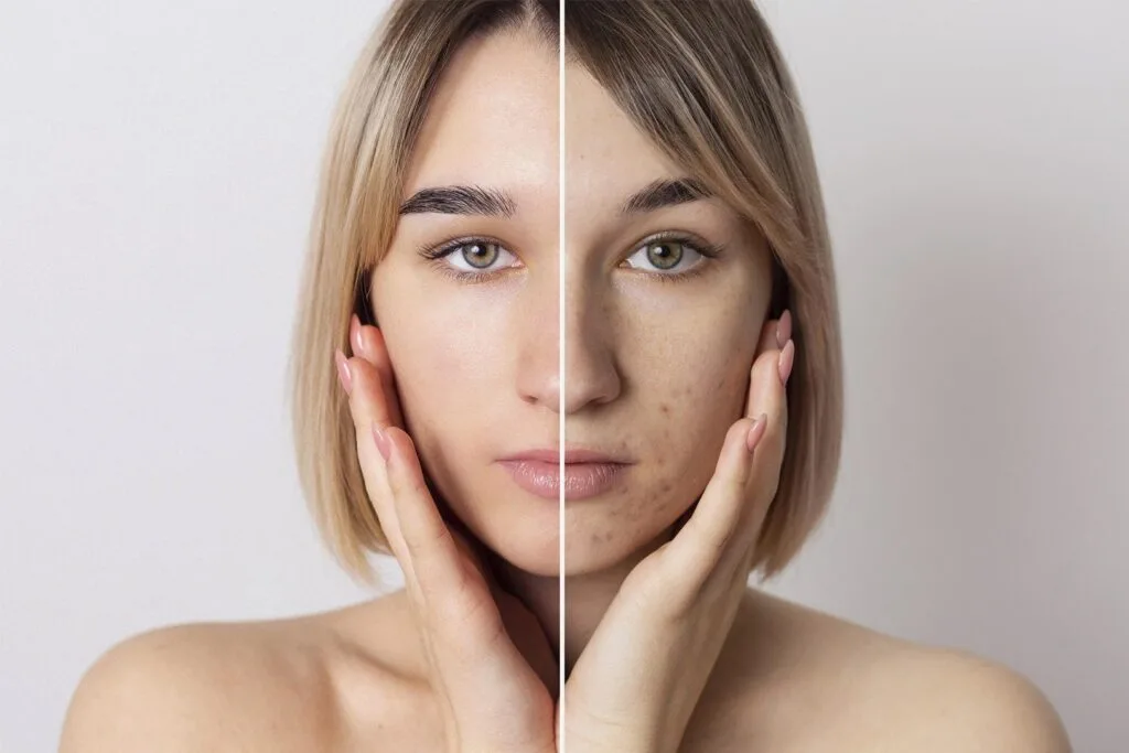 como-escoger-el-peeling-para-tu-tipo-de-piel