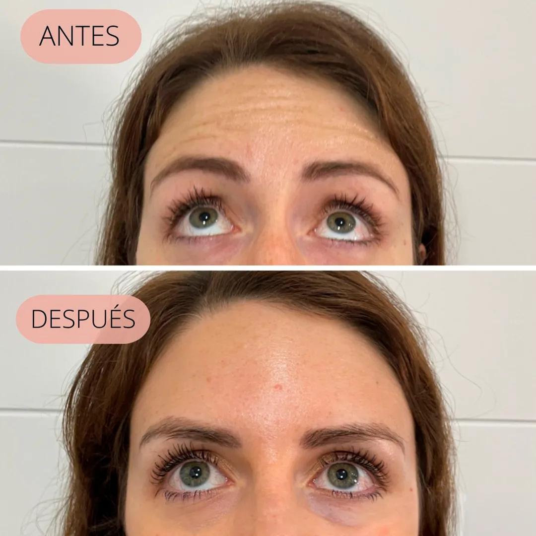 arrugas-1