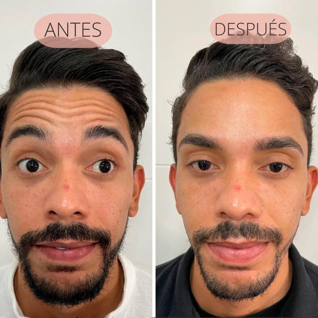 arrugas-2