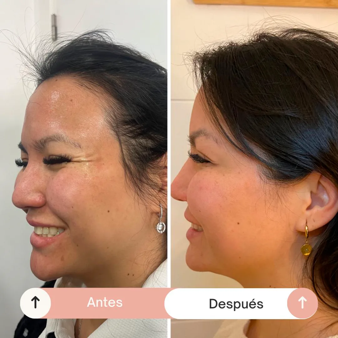 arrugas-3