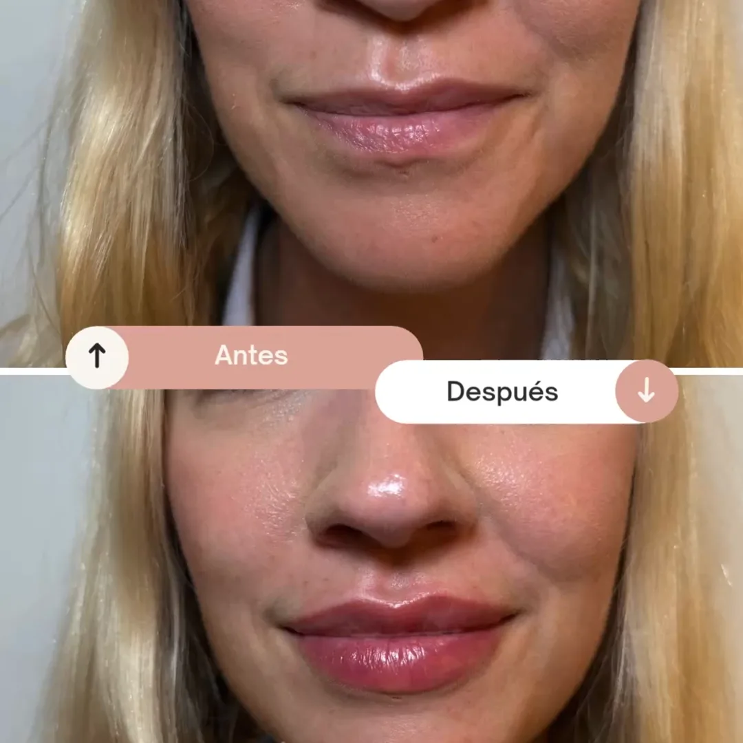 aumentos-2