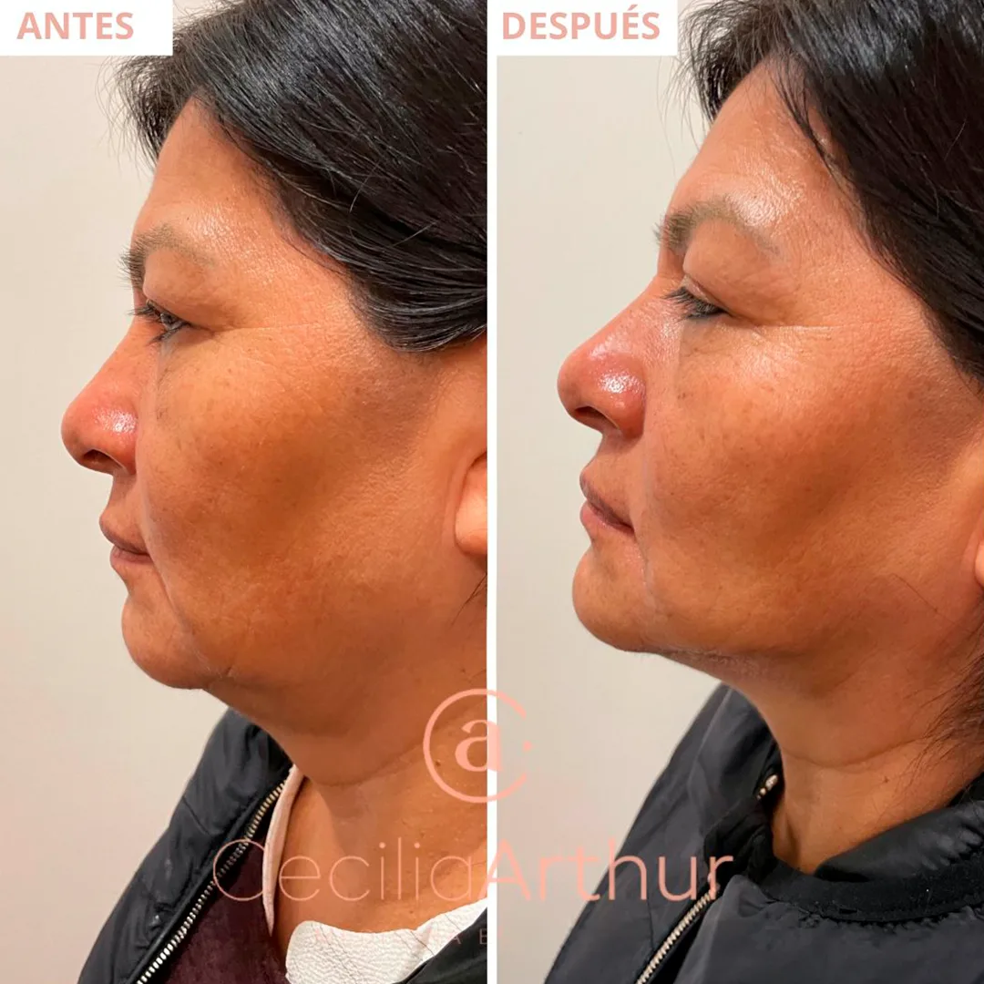 mandibula-2